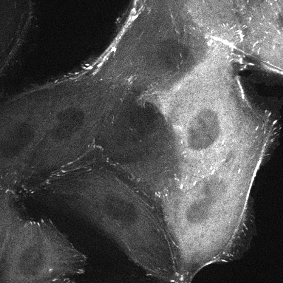 Investigating how mechanical forces affect cells is critical to understanding diseases like cancer, commonly characterized by abnormal cell adhesion. Courtesy image from Joleen Cheah