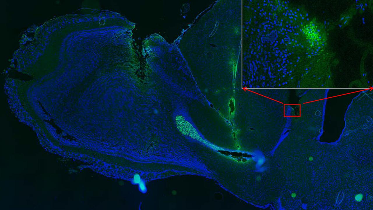 Section of rat brain