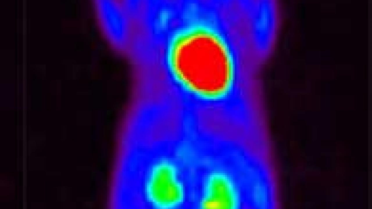 Photo: computerized image of tumor in mouse