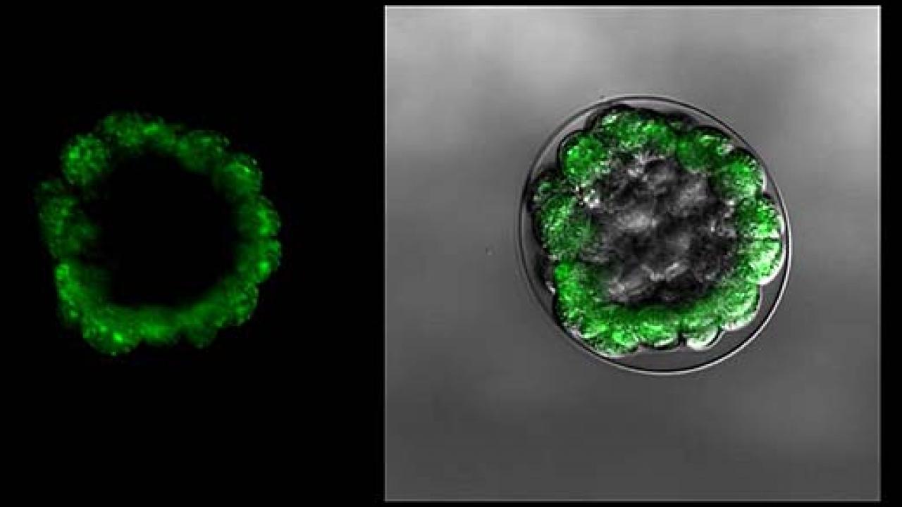 Two green rings, one on a black background, one on a silver