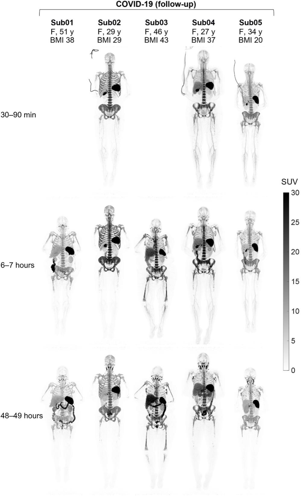 X-ray skeletal images arranged in a grid five wide by three deep. 