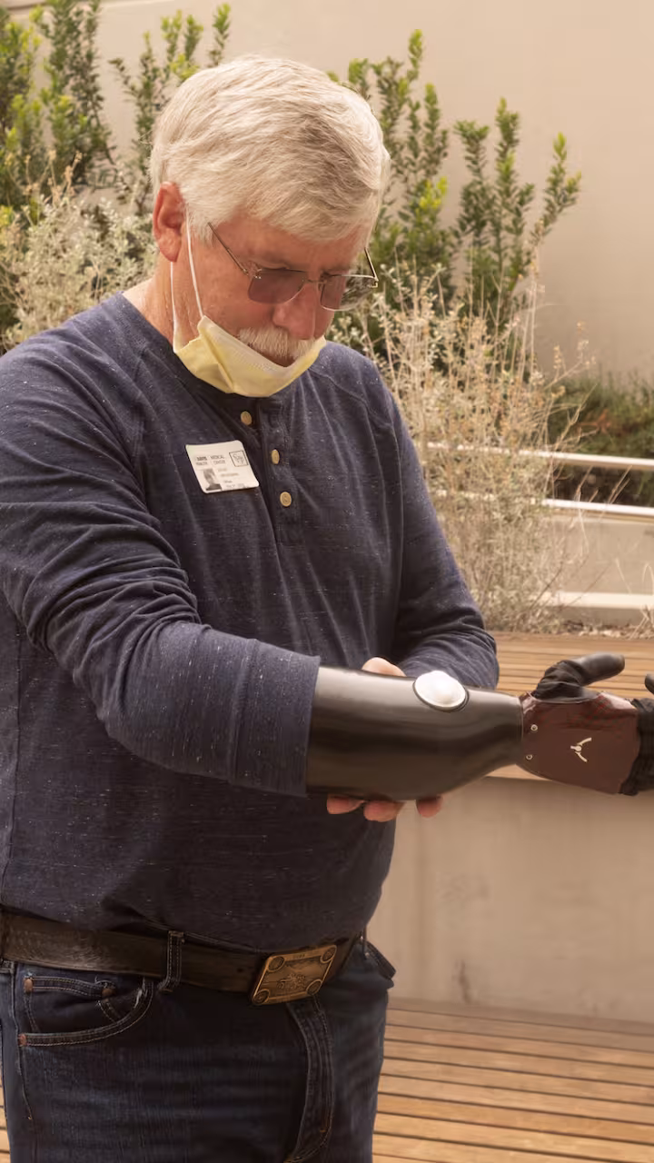David Brockman, a retired firefighter and hand amputee, shows off his new myoelectric prosthetic device.