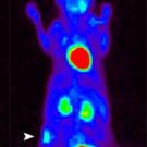 Photo: computerized image of tumor in mouse