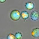 Microscope micrograph of round green cells with bright orange fluorescent spots