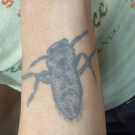 backswimmer on arm