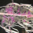 Against a black background, a tangle of translucent white fibers interspersed with purple fibers. 